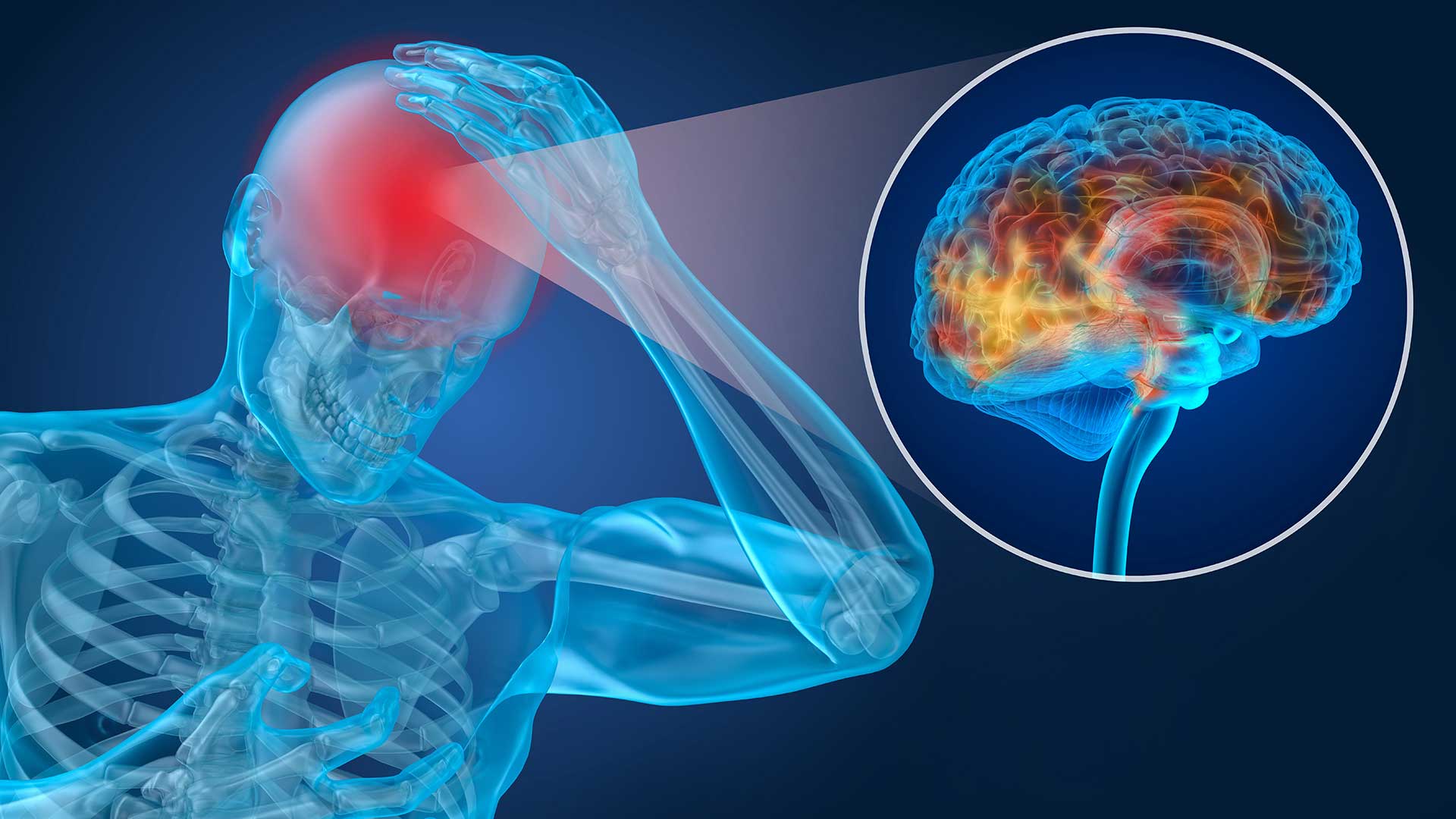 HHPI Concussion and mTBI Rehabilitation